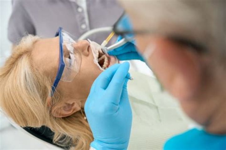 Are black dots on teeth cavities?