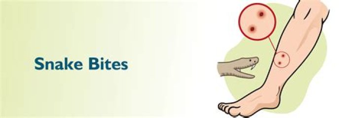 Are dogs more resistant to snake bites?