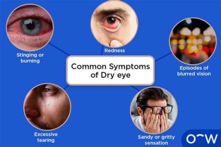 Are dry eyes a symptom of diabetes?