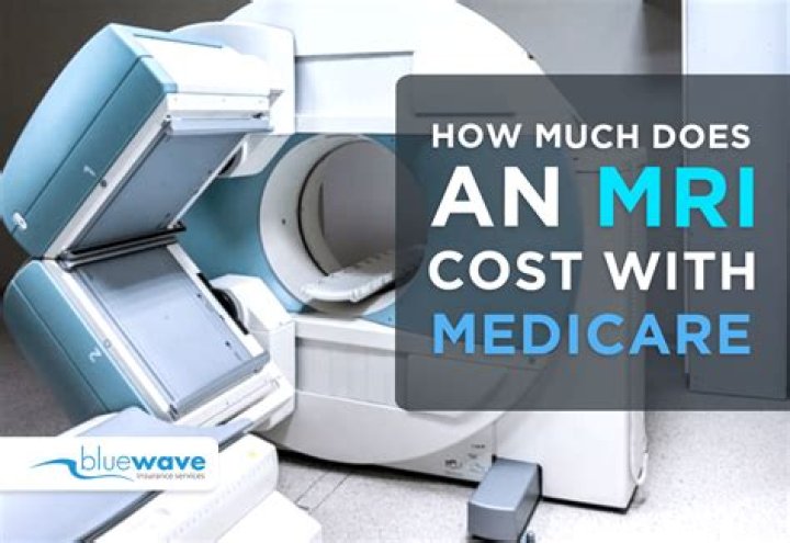 Are MRI covered by Medicare?