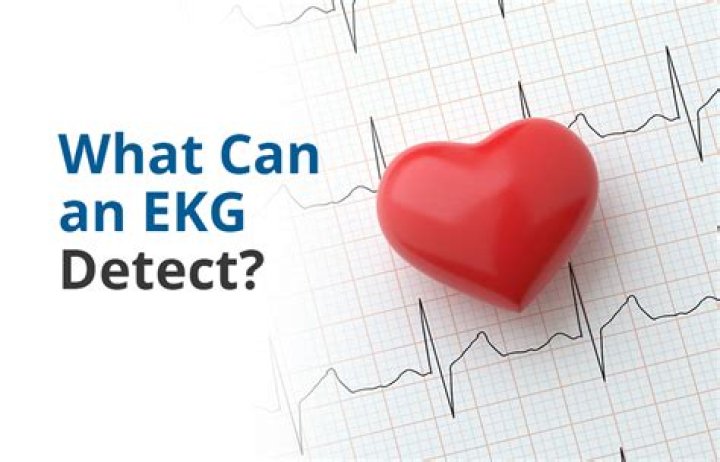 Can an EKG detect angina?