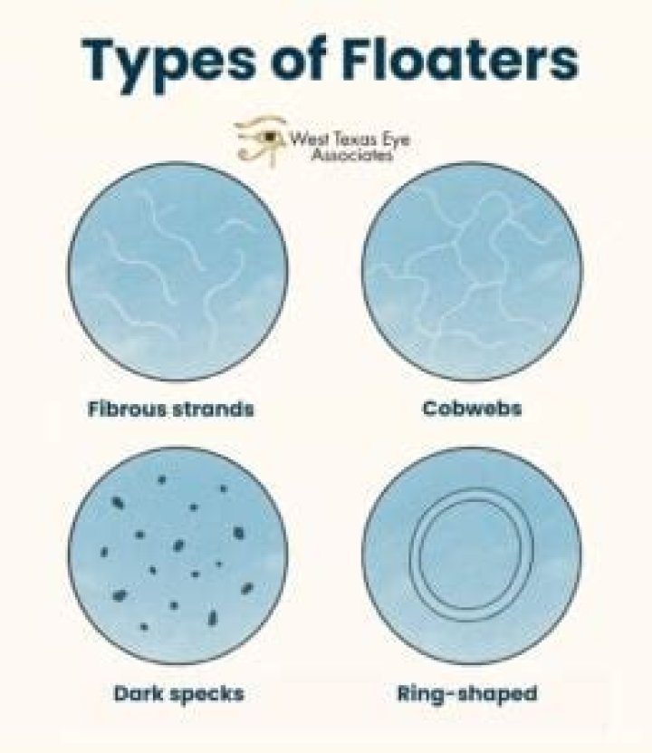 Can floaters look like bugs?