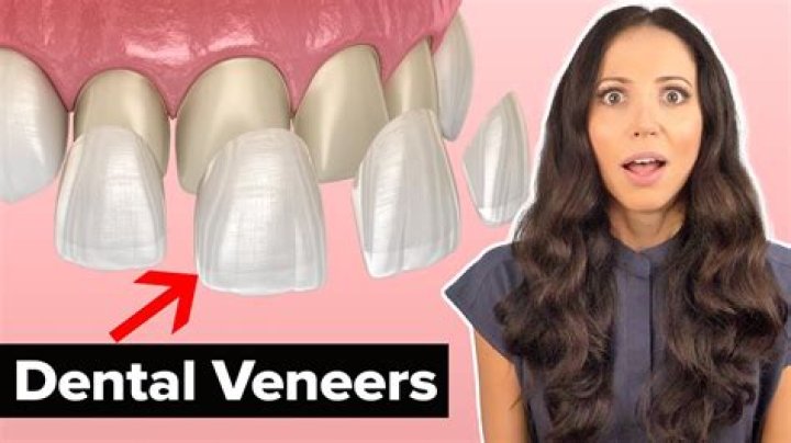 Can I get veneers while pregnant?