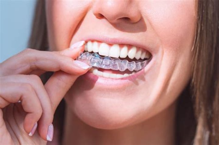 Can I take my Invisalign out for a day?