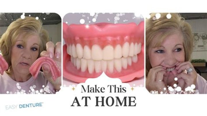 Can immediate dentures be made in one day?