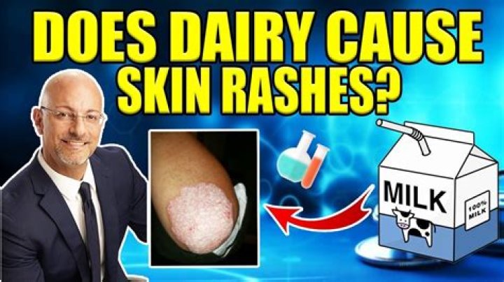 Can milk cause skin problems?