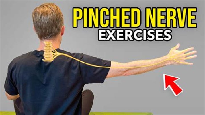 Can physical therapy fix a pinched nerve?