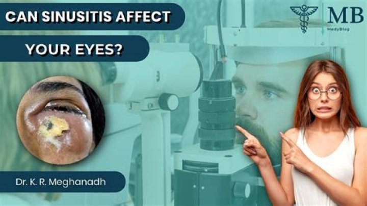 Can sinusitis affect your heart?