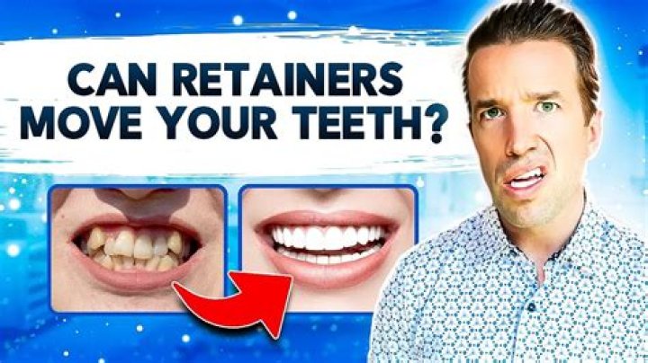 Can you kiss with retainers?