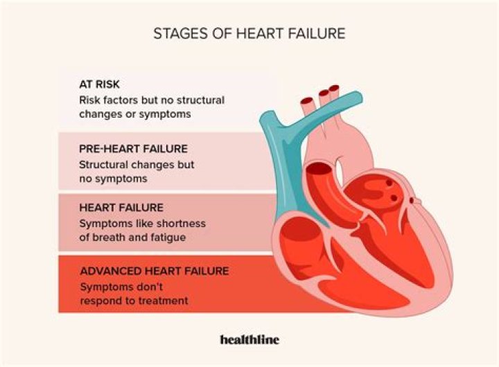 Can you slow down heart failure?