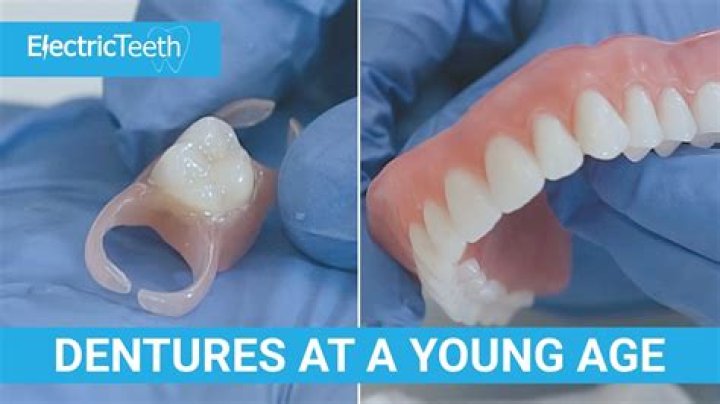 Do dentures age your face?