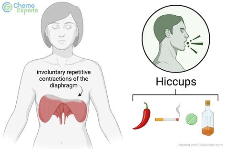 Does hiccups mean overfeeding?