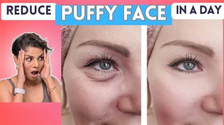 How can I reduce my puffy face?