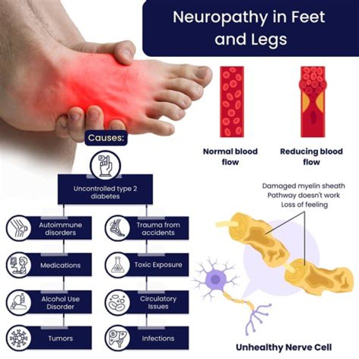 How can I sleep with neuropathy in my feet?