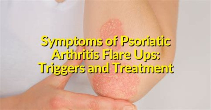 How do you calm down a psoriasis flare up?