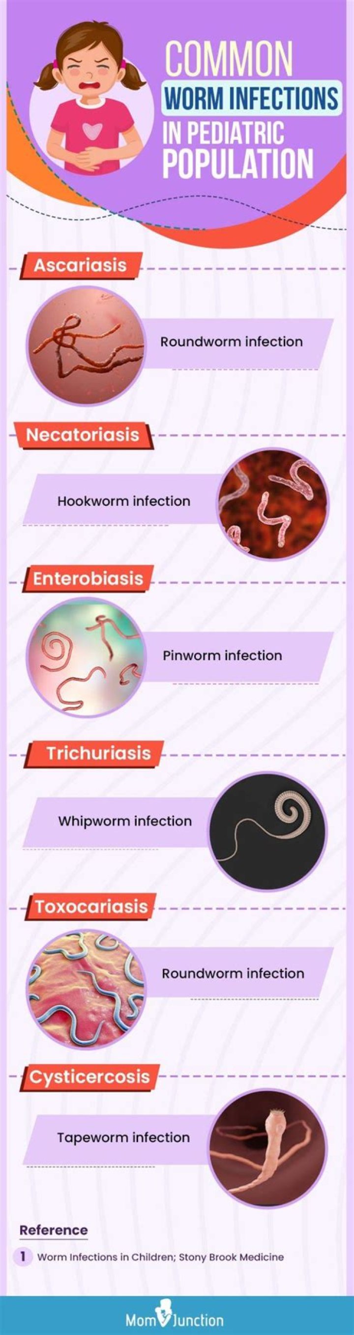How do you know if you have roundworms in humans?