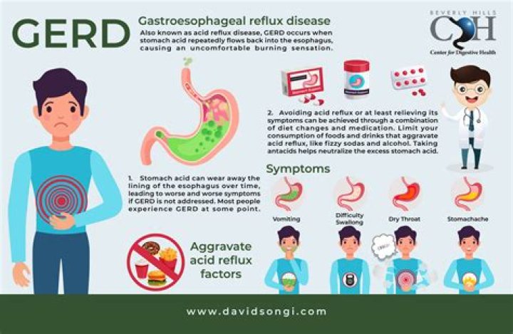 How do you know if your GERD is severe?