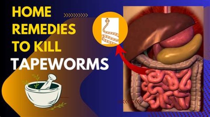 How do you tell if I have tapeworms?