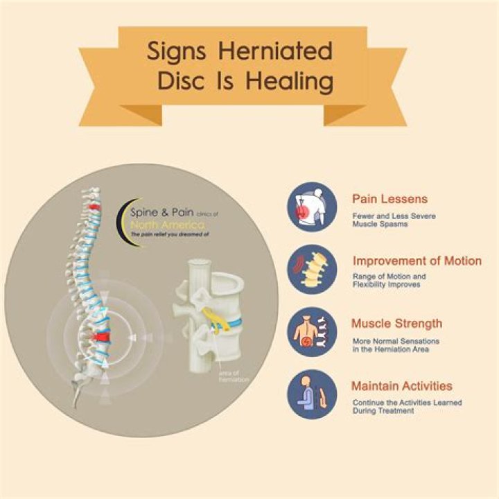 How long can a herniated disc last?
