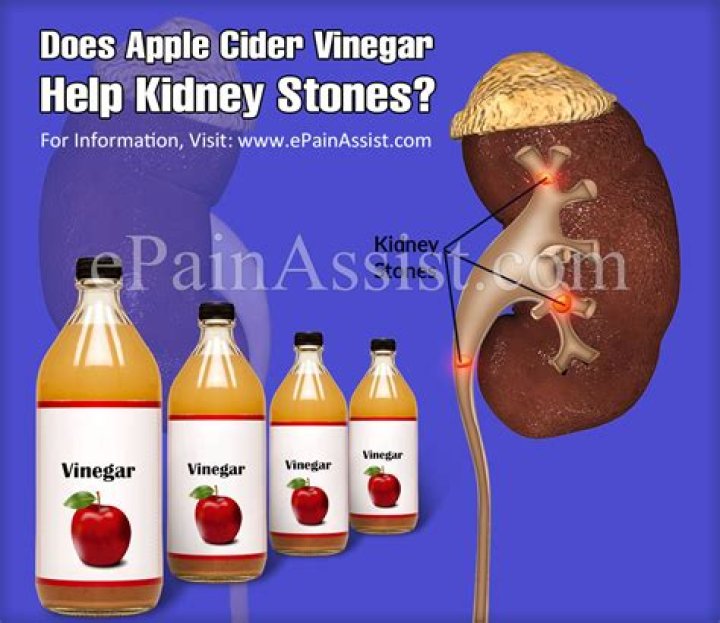 How much apple cider vinegar should I drink for my kidneys?