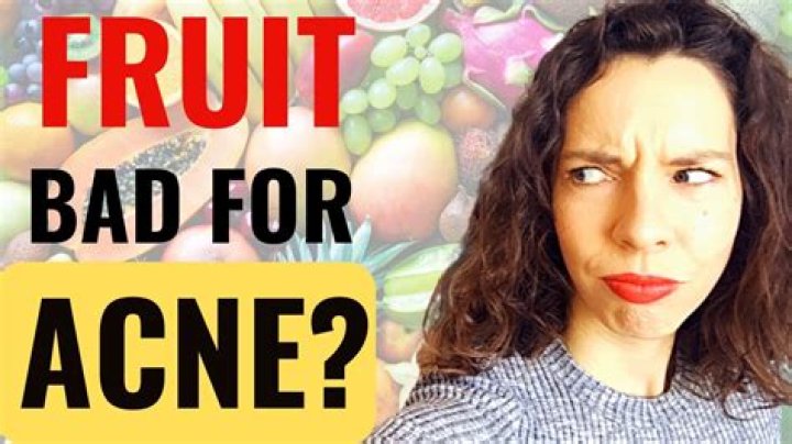 Is fruit bad for acne?