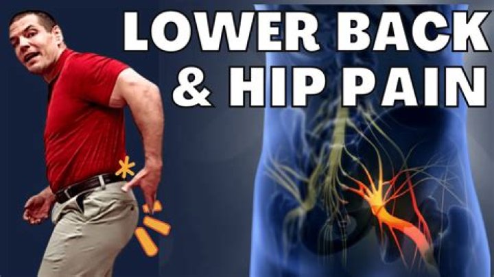 Is it hip or back pain?
