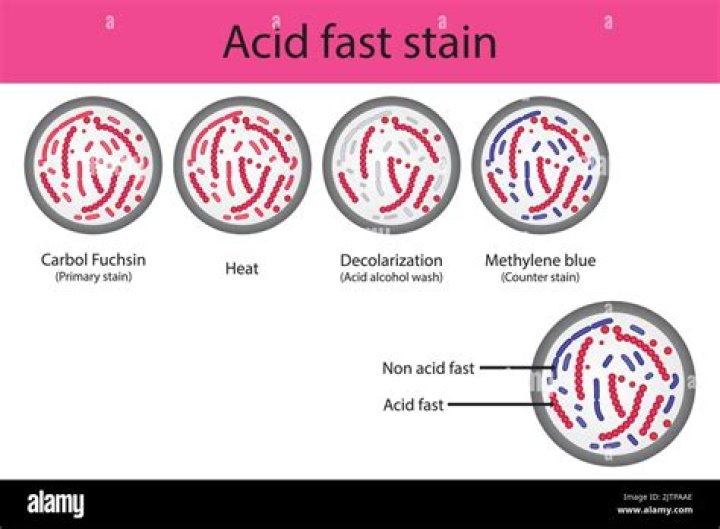 Is Mycoplasma acid-fast?
