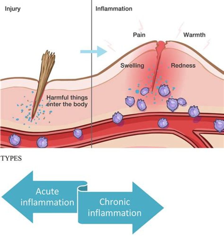 What are systemic signs of inflammation?