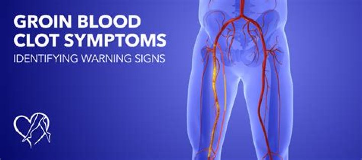 What are the symptoms of a blood clot in the groin area?