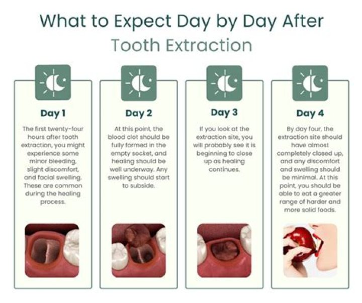 What can I eat 3 days after oral surgery?