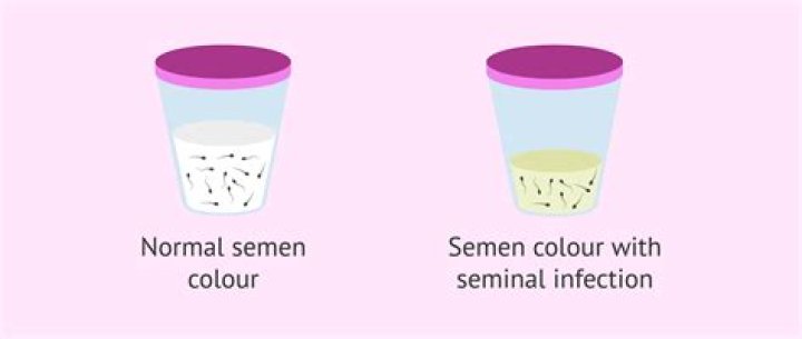 What color is healthy sperm?