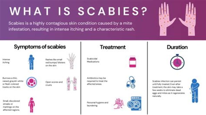 What does a scabies outbreak look like?