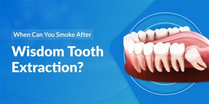 What if I smoke after a tooth extraction?