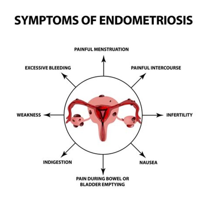What is burnt out endometriosis?