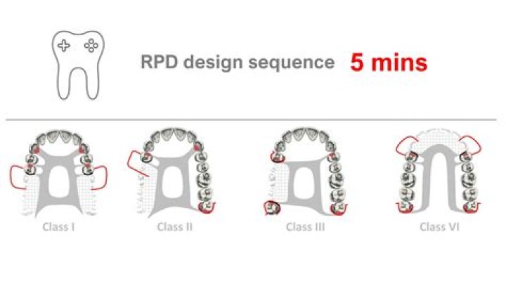What is the difference between RPD and RSD?