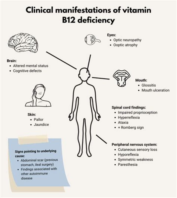 What is the most common cause of vitamin B12 deficiency?
