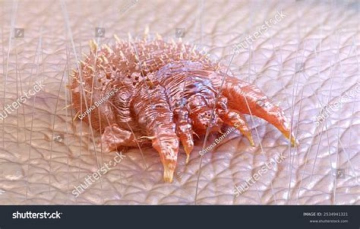 What kind of mites burrow in human skin?