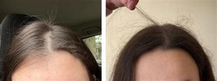 What to do with stray hairs after waxing?