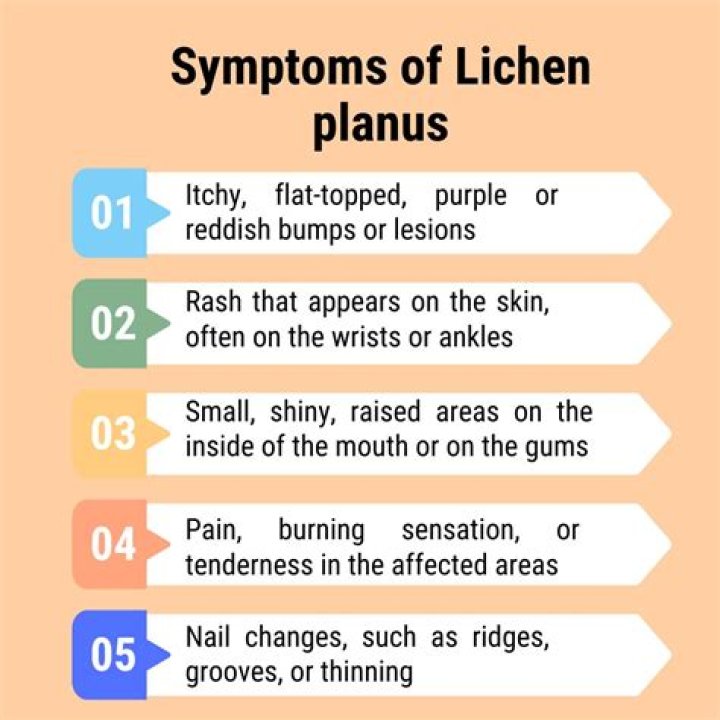 What triggers lichen planus?