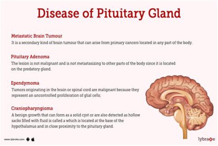 What vitamins are good for your pituitary gland?