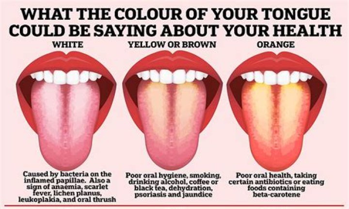 What your tongue color means?