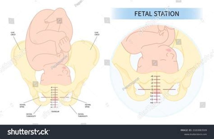 Where is the womb located left or right?