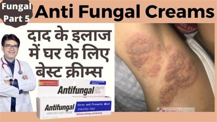 Which cream is best for fungal infection?