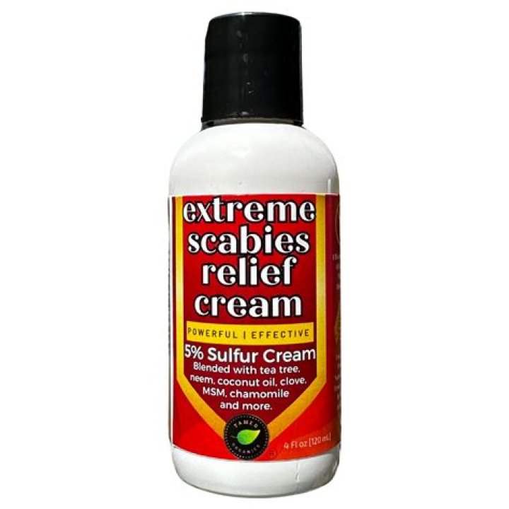 Will vinegar get rid of scabies?